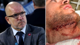 Tom Fitzgerald et son fils Casey blessé