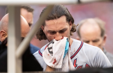 Un tir à 91 MPH atteint Culberson au visage