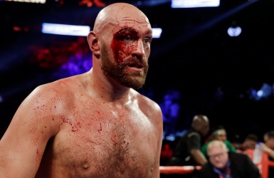Tyson Fury pourra-t-il guérir à temps ?